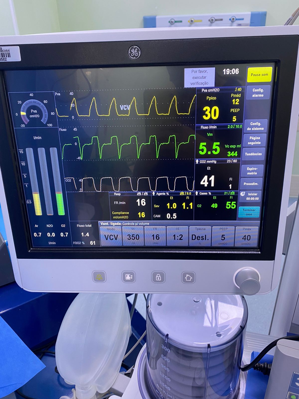 Ventilação Mecânica 1